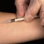 Mantoux TB Skin Test Unsafe and Unreliable