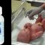 Bio-K-Mulsion: A Safer Option Than Synthetic Vitamin K for Newborns